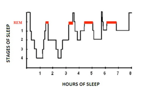 Hypnogram-of-sleep-cycle-in-a-healthy-young-adult-Normal-sleep-involves-cycling.png