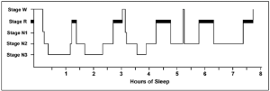 A-hypnogram-showing-normal-distribution-of-sleep-stages.png